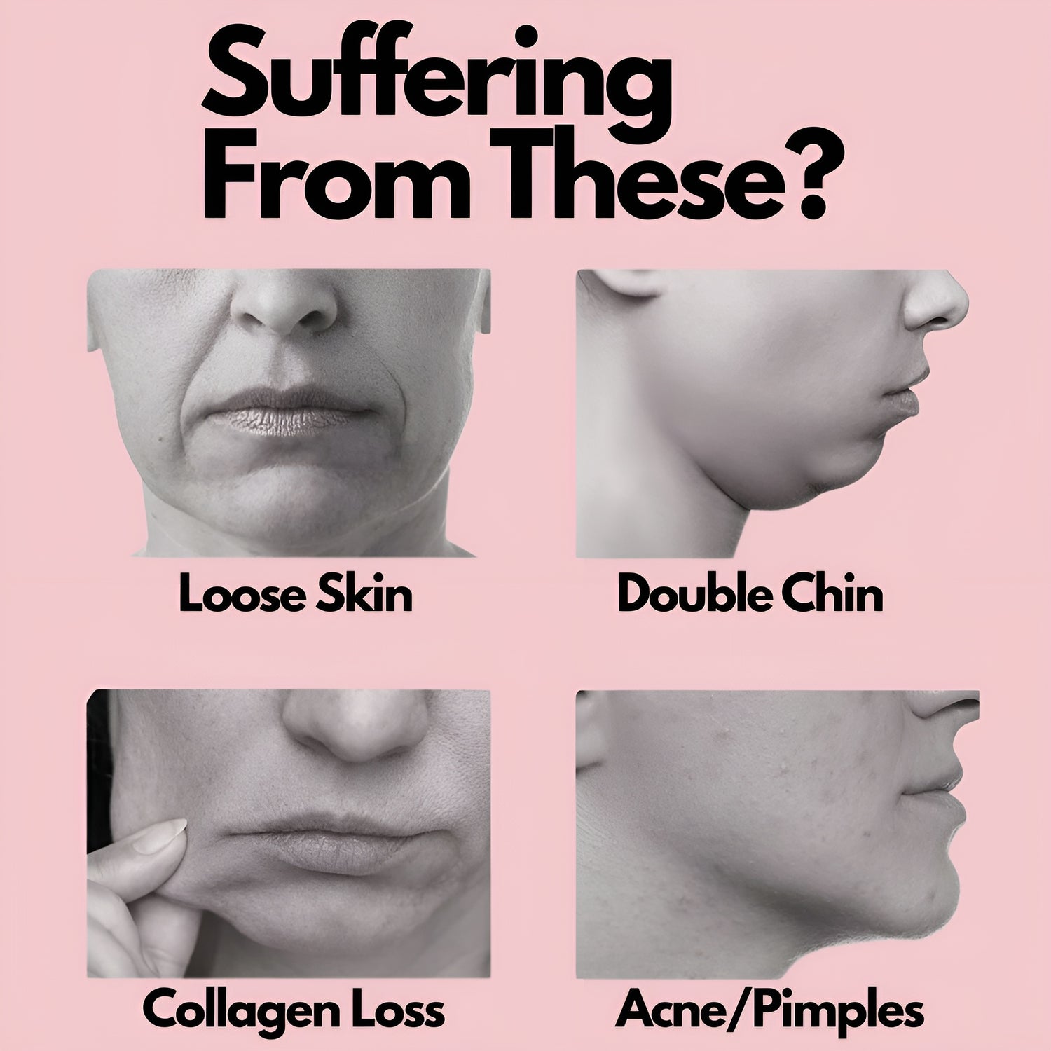 ContourVLift™ Bundle